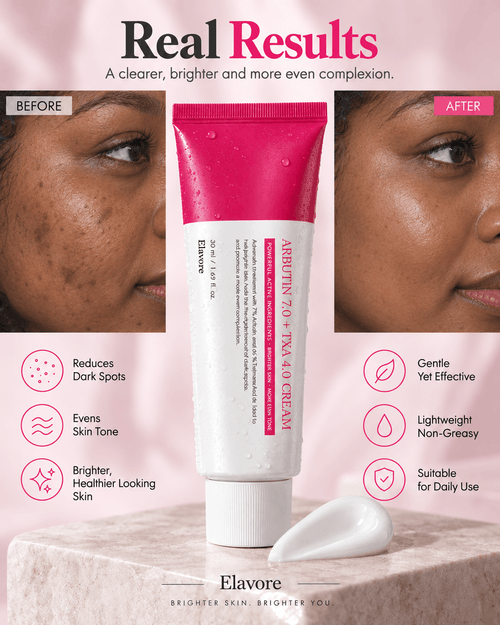 Korean Advanced Arbutin Dark Spot Cream