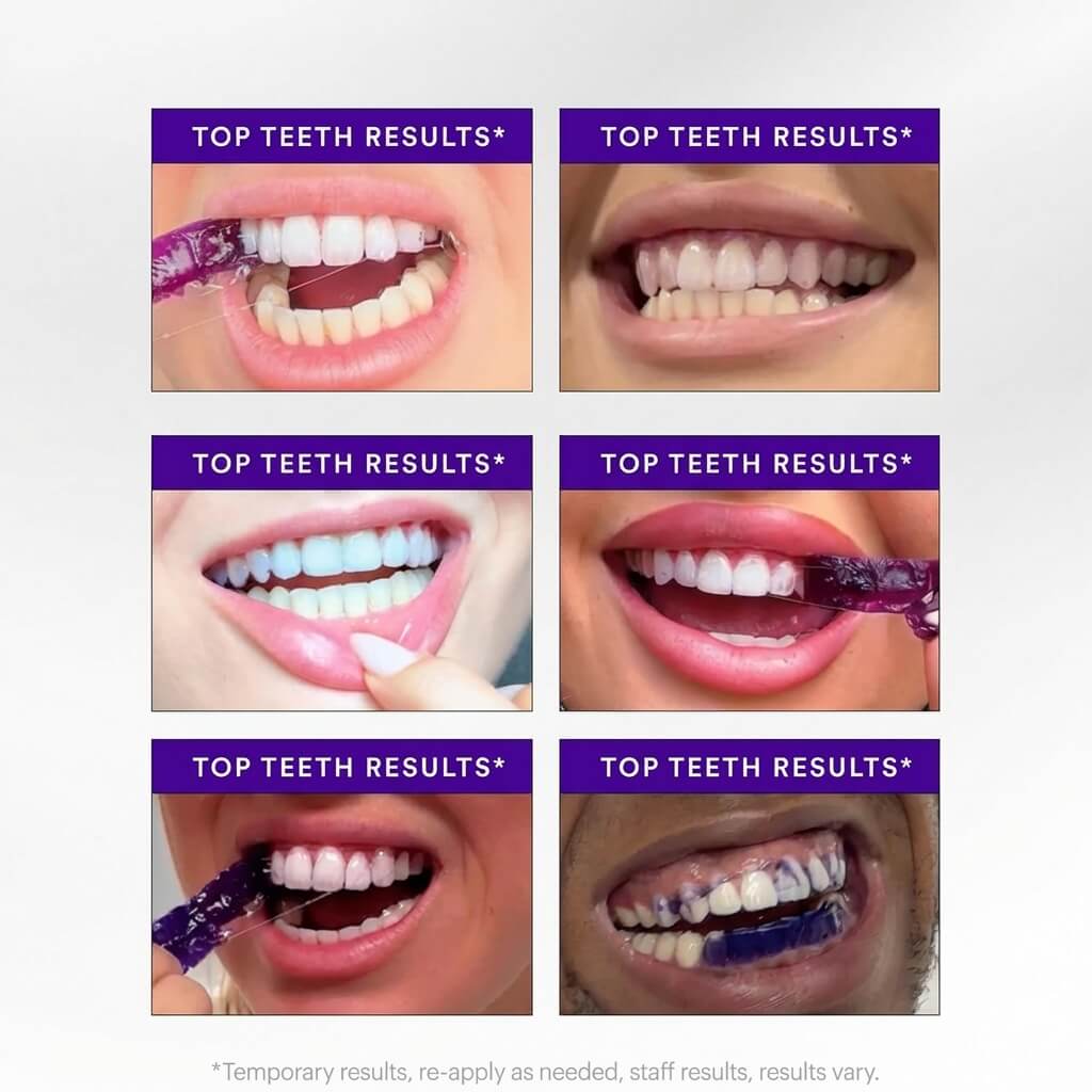 Colour Correcting Whitening Strips | Professional Teeth Whitening Kit with PAP+ Technology